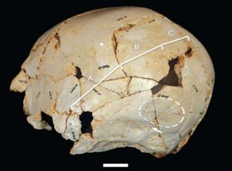Reconstrucción del cráneo asimétrico de Benjamina
